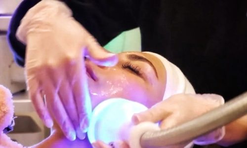 Double Chin Reduction