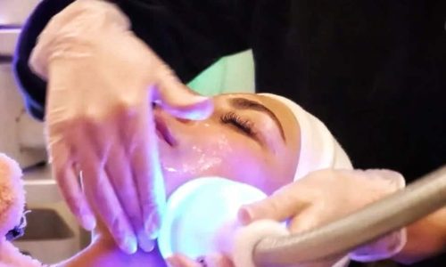 Double Chin Reduction